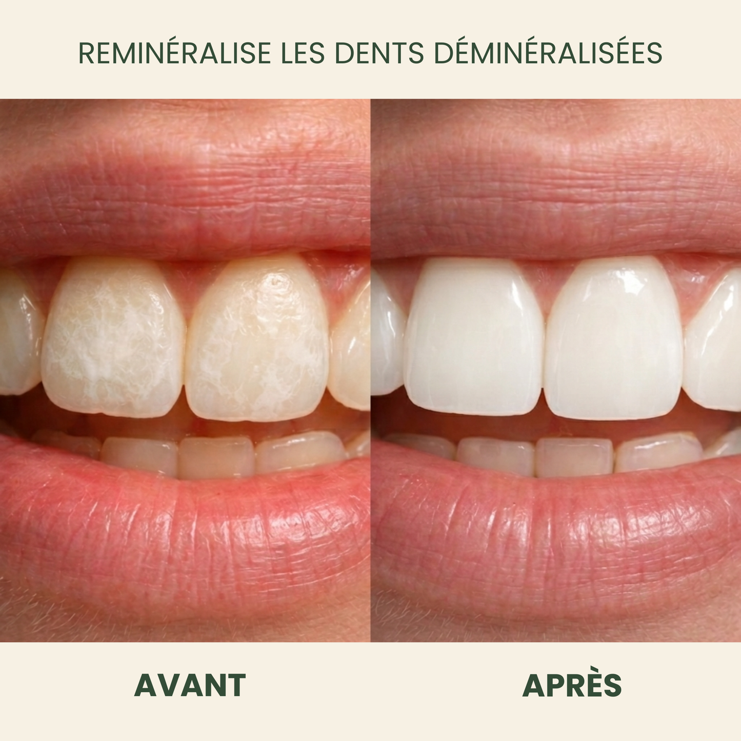 Holariss Chewing-gum Reminéralisant