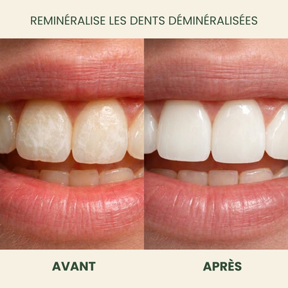Holariss Chewing-gum Reminéralisant