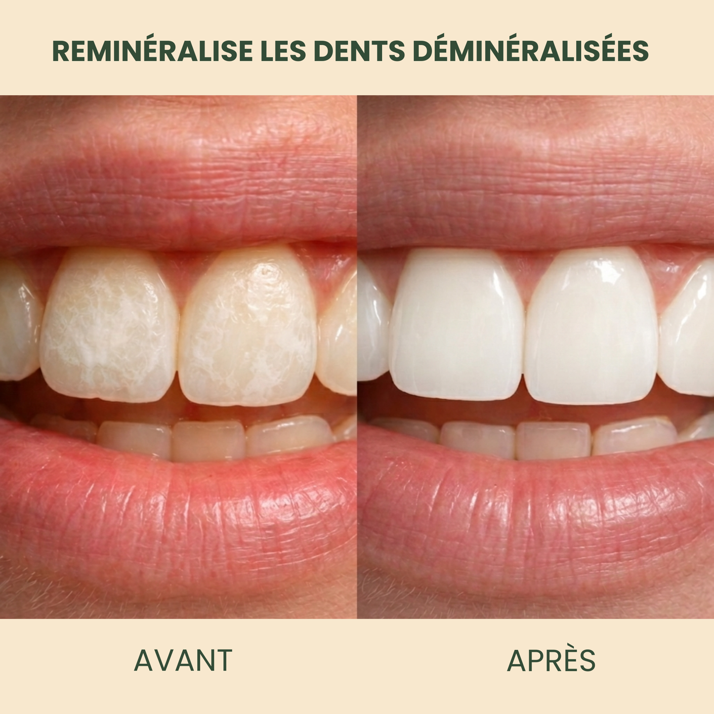 Holariss Chewing-gum Reminéralisant ( Canelle )