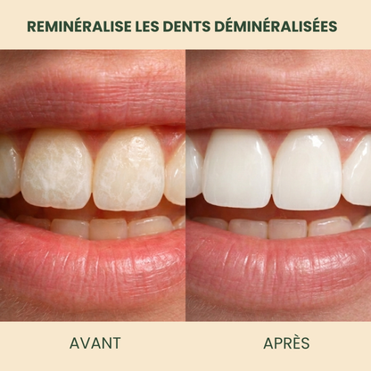 Holariss Chewing-gum Reminéralisant ( Canelle )